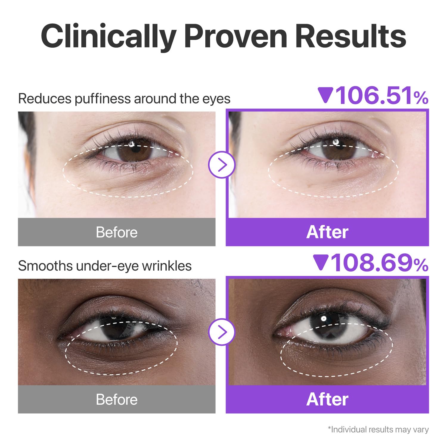 Numbuzin- No.9 NAD Collagen Under Eye Patches