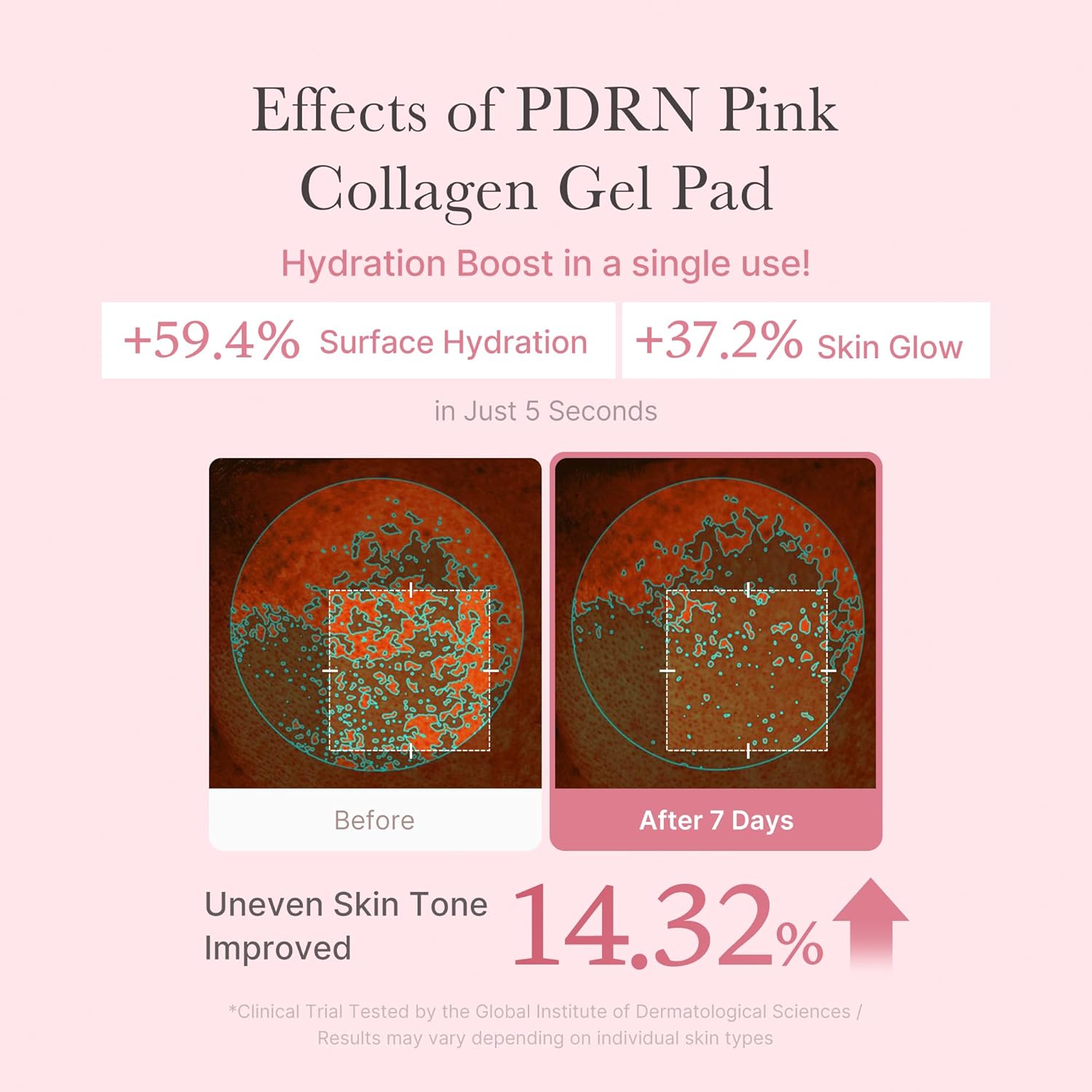 Medicube PDRN Pink Collagen Toning Gel Toner Pad, 70 pads